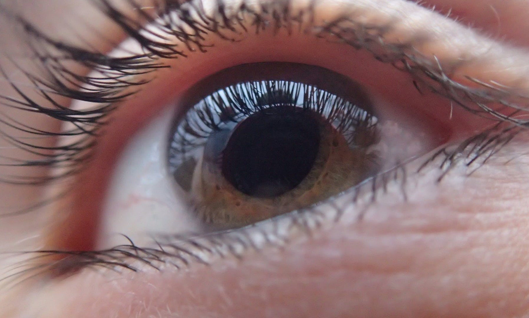 Eyesight Care: A Clear Vision of Holistic Wellness